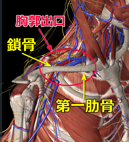 胸郭出口症候群の画像