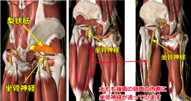 梨状筋症候群図