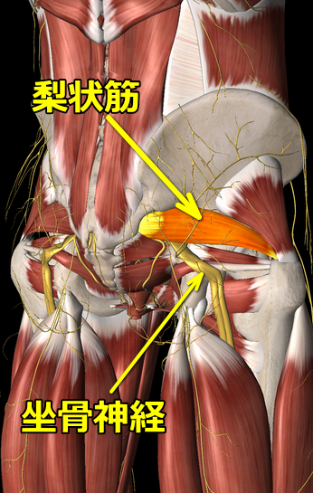 梨状筋症候群の図